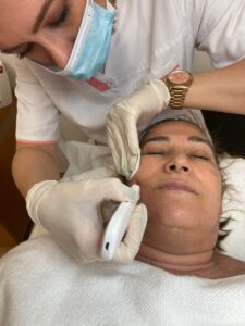 Peeling químico -tratamiento facial-peluquería y estética Orquidea en Sant Martí de procençals
